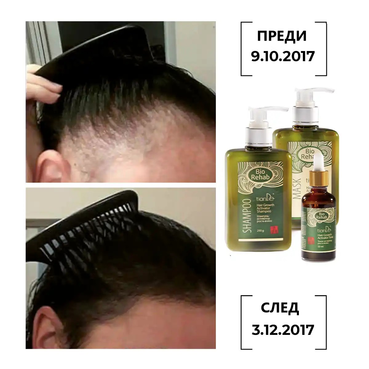 комплект Bio Rehab