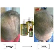 комплект Bio Rehab