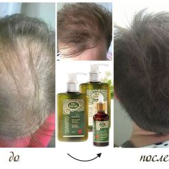 BIO REHAB бърз растеж на косата