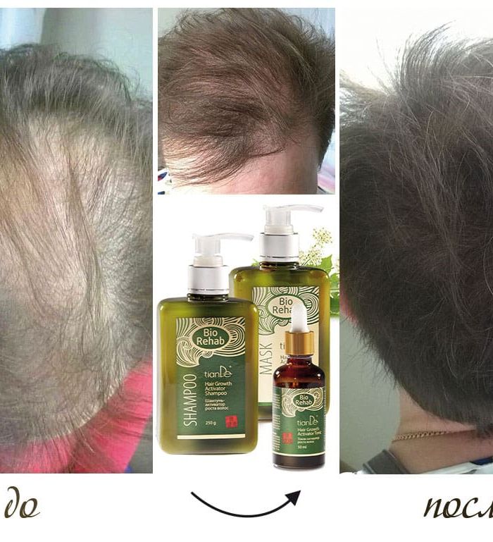 BIO REHAB комплект за бърз растеж на косата ПРОМО