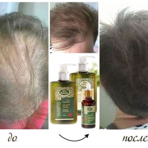 BIO REHAB комплект за бърз растеж на косата ПРОМО